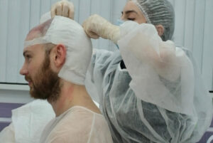 Пересадка волос Гормедцентр
